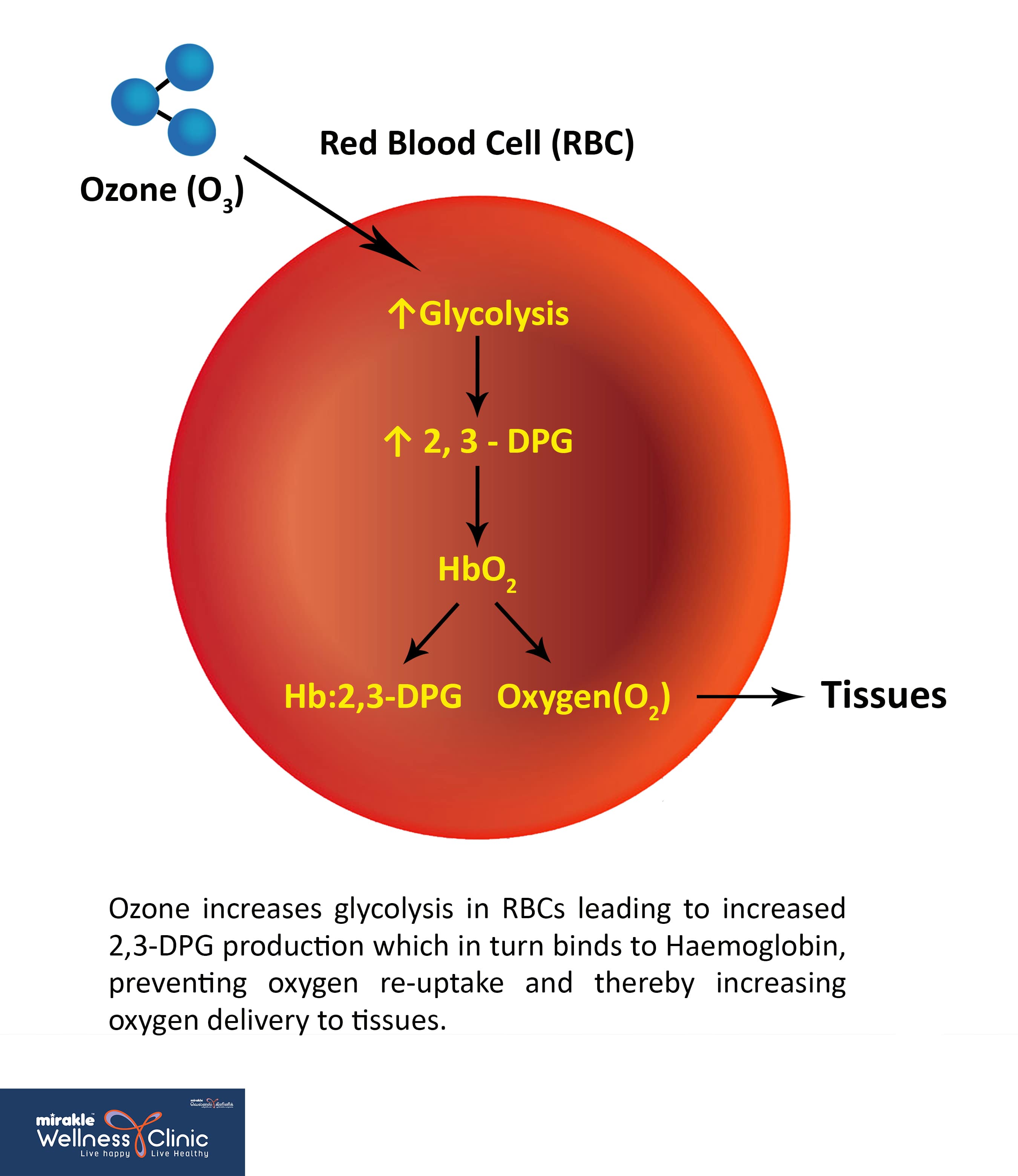 How Ozone Therapy in Heart Works