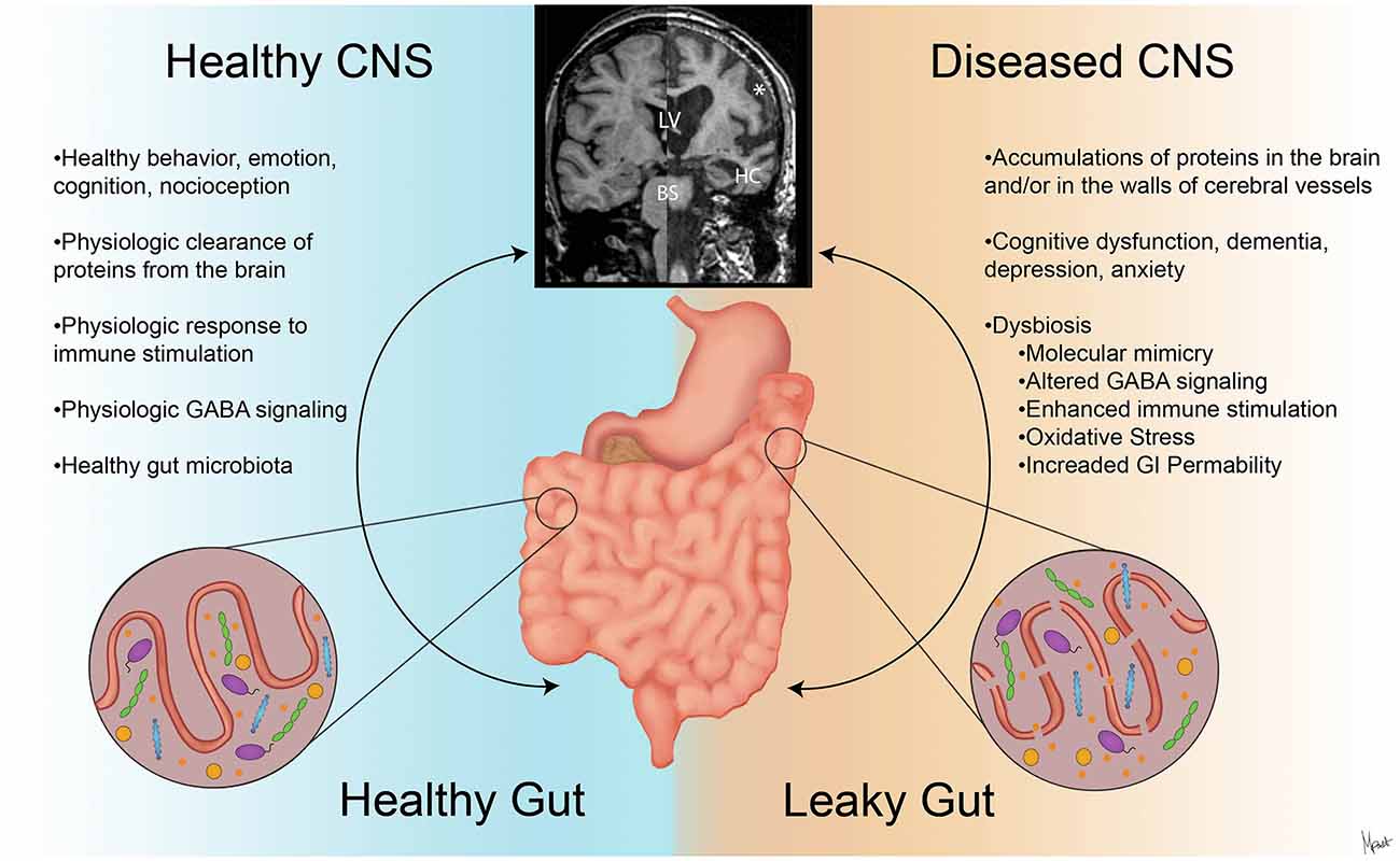 Improving Gut Health