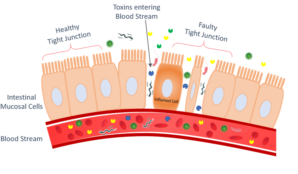 Leaky gut therapy india